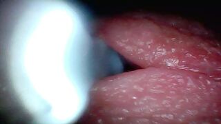Endoscope online camera captures moment of male ejaculation